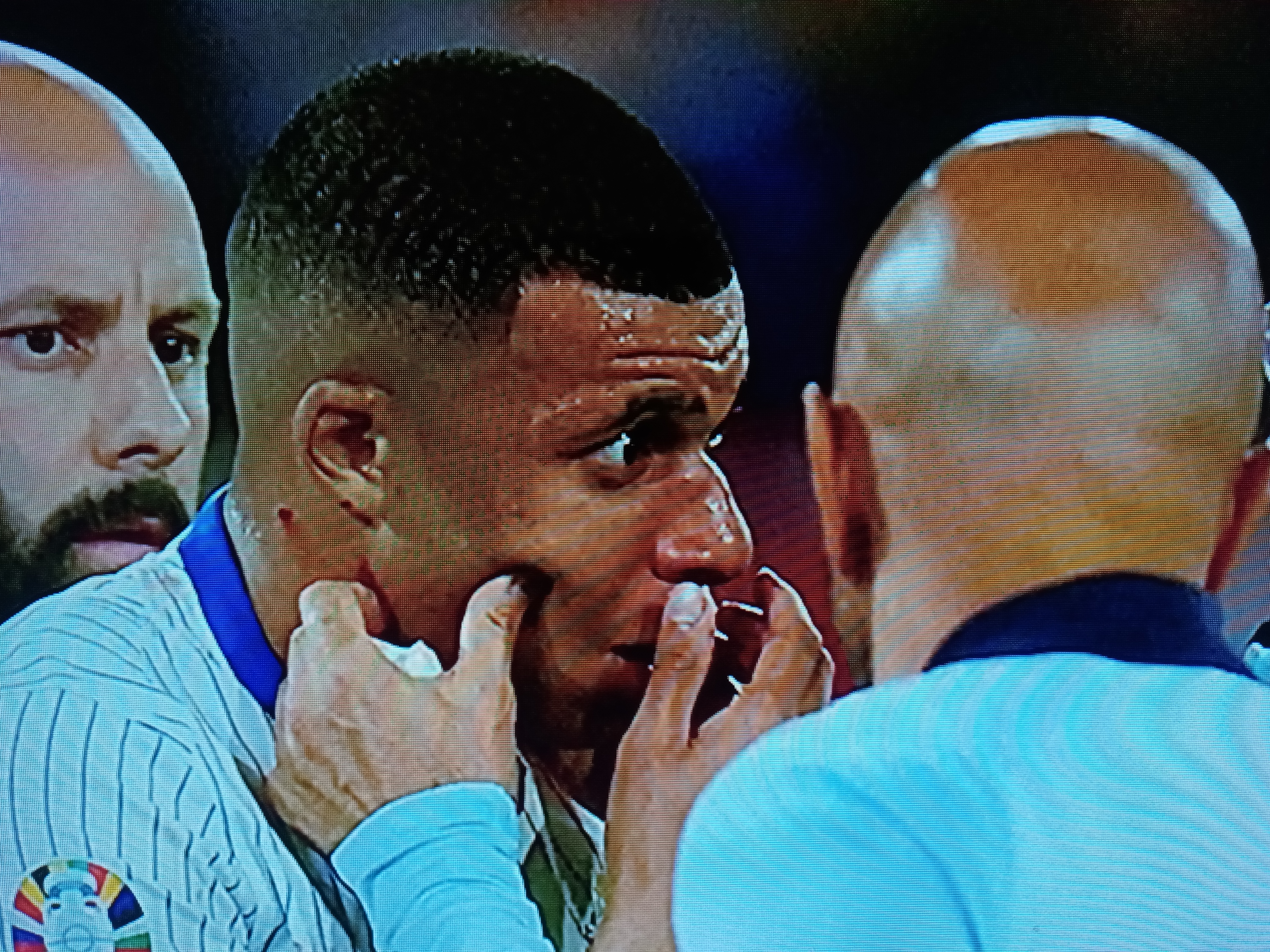 法国球员姆巴佩爆冷受伤！或将缺席欧洲杯决赛